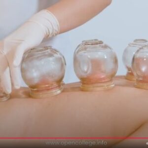 Cupping-Therapy-course