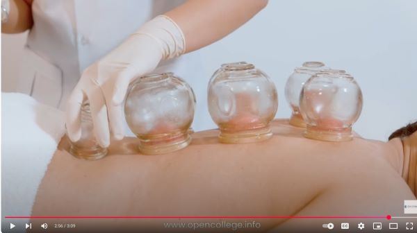 Cupping-Therapy-course